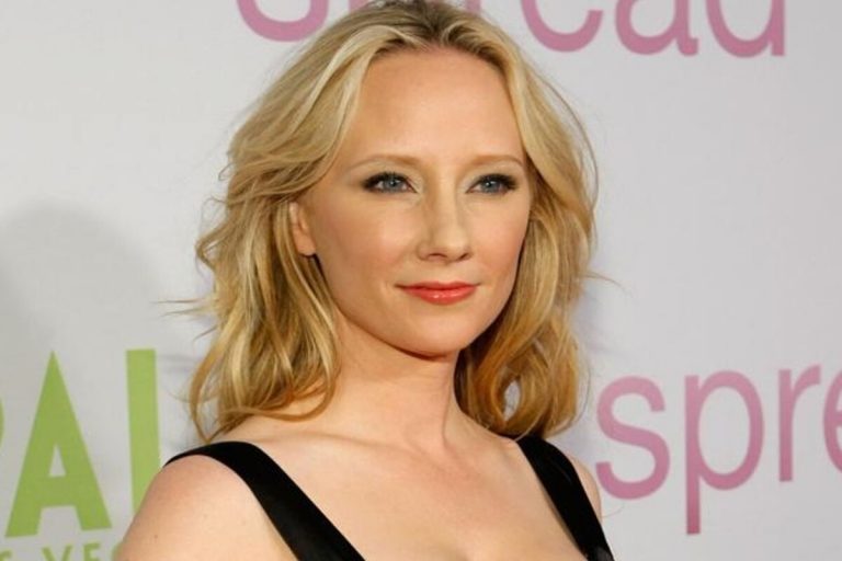 Anne Heche cerebralmente morta