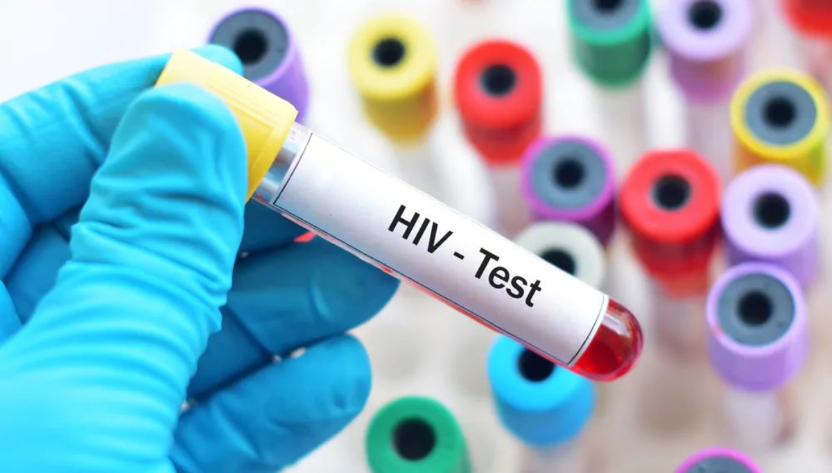 Hiv, nasconde all'ex compagna di essere sieropositivo e la contagia a processo