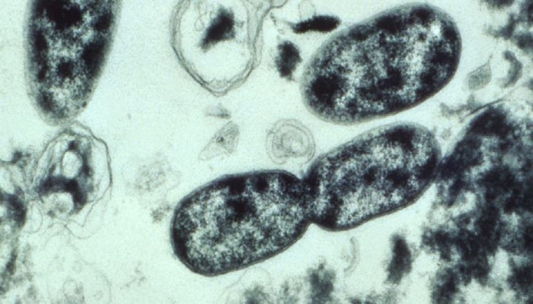 Indentificata la Legionella a Palermo