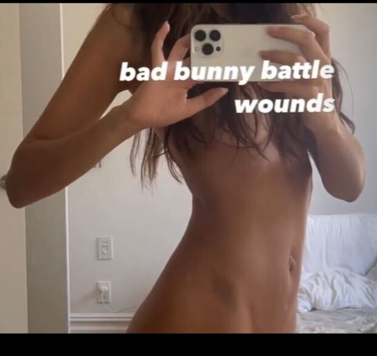 emily livido