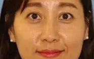 Young Sook an