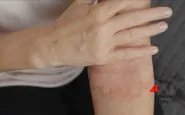 featured 1836558