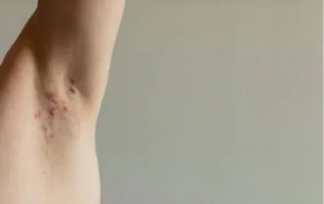 featured 1935835 364x230