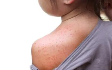 featured 1950154 364x230