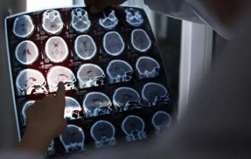 featured 1968659 364x230