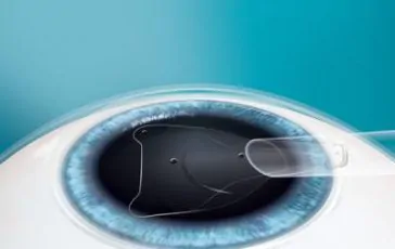 featured 2099762 364x230