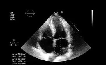 featured 2122004 364x225