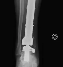 featured 2129895 217x230