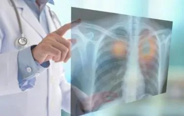 featured 2147042 364x230