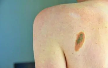 featured 2159305 364x230