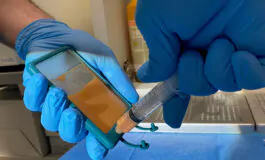 Come il metodo del Dottor Cosimi migliora gli interventi in ambito proctologico