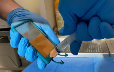 Come il metodo del Dottor Cosimi migliora gli interventi in ambito proctologico