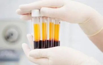 featured 2308451 364x230