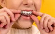 Apparecchi trasparenti: il futuro dell’ortodonzia estetica