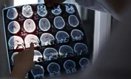 featured 2744717 265x160