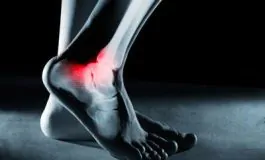 featured 2831669 265x160