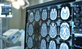 featured 2868856 265x160