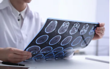 featured 2908189 364x230