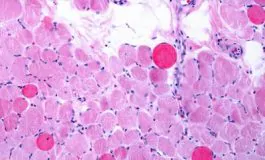 featured 2932823 265x160