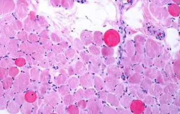 featured 2932823 364x230