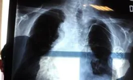 featured 2959962 265x160