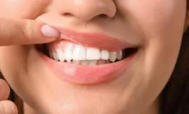 featured 2975382 265x160