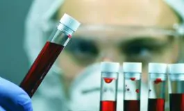 featured 3175327 265x160