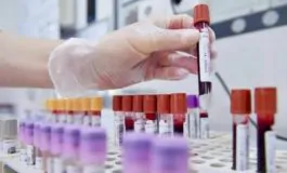 featured 3502601 265x160