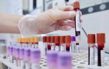 featured 3502601 364x230