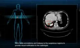 featured 3518667 265x160