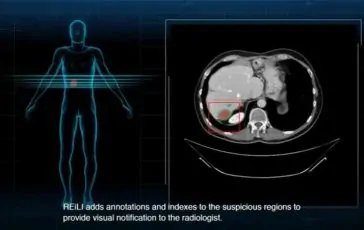 featured 3518667 364x230