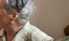 Quando le McSC bloccate interrompono il pigmento: ecco la sorpresa dello studio americano