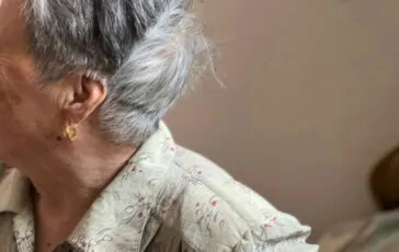 Quando le McSC bloccate interrompono il pigmento: ecco la sorpresa dello studio americano