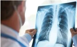 featured 3582585 265x160