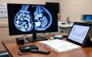 intelligenza artificiale e screening mammografico cosa cambia per i pazienti 1772319808