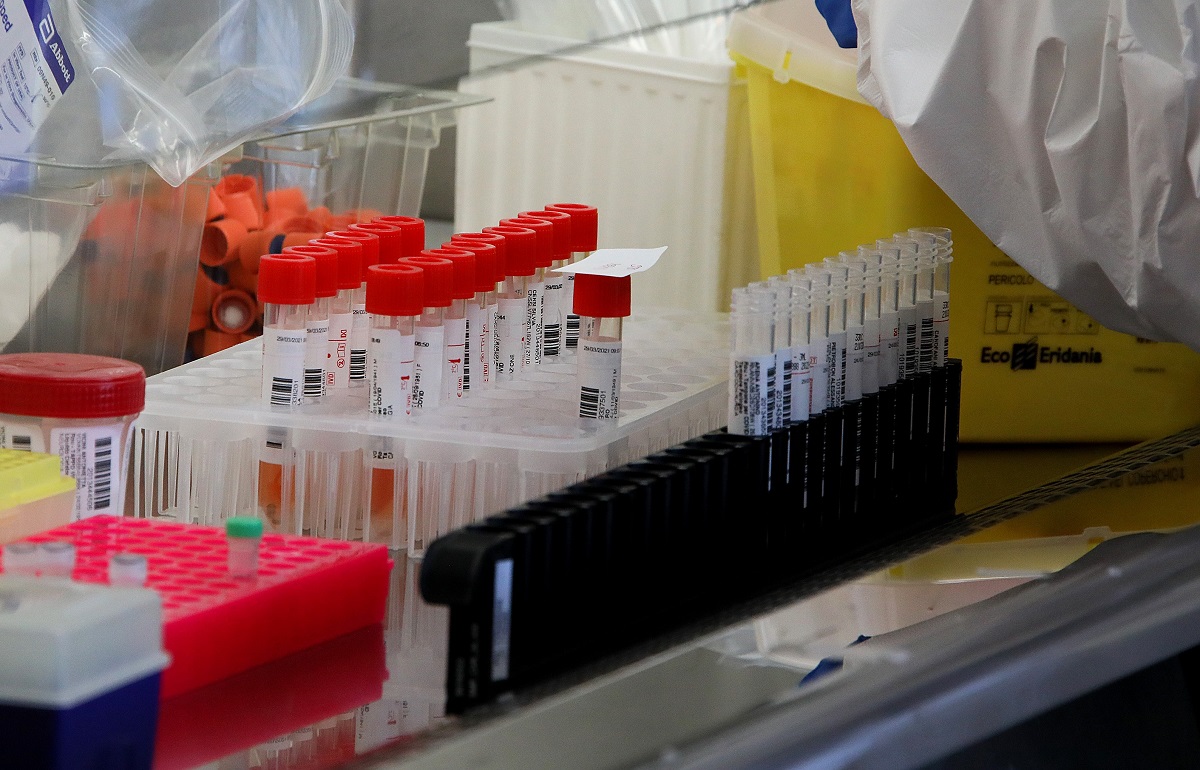 https://www.notizie.it/wp-content/uploads/2026/05/focolaio-di-hantavirus-individuato-il-paziente-zero-i-viaggi-e-il-decesso-della-d01c08d0.jpg