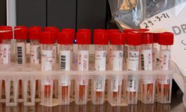 Hantavirus sintomi contagio