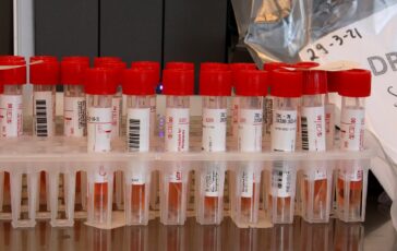 epidemia di Ebola