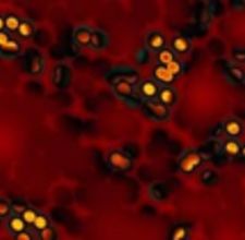 article page main ehow images a07 2p o2 lower hemoglobin 800x800