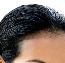 article page main ehow images a04 87 nn rid forehead wrinkles 800x800