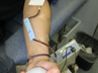 article preview ehow images a05 9v 1b special rh negative blood 1.1 800x800