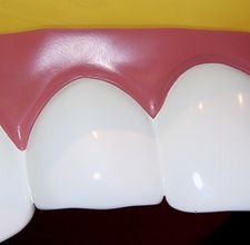 article page main ehow images a02 74 hb whiten teeth hydrogen peroxide 800x800